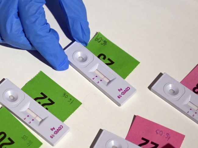 V Košiciach pokračuje plošné testovanie, v piatok odhalili 183 pozitívnych