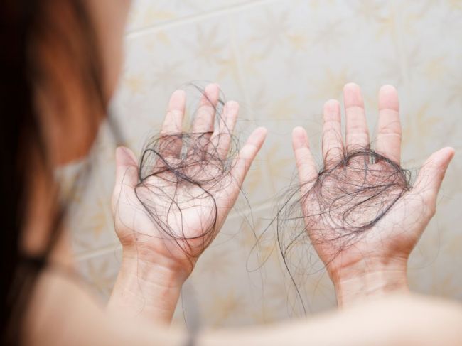 7 spôsobov, ako zistiť, či ste obeťou nadmerného vypadávania vlasov
