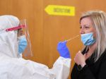 Najviac prípadov COVID-19 bolo počas ôsmeho týždňa medzi 40 až 49-ročnými