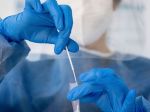 Na Slovensku dôjde k zmene testovacej stratégie, pribudne nový typ testov