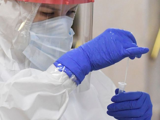 Laboratórium v Brne odhalilo dosiaľ nepopísanú mutáciu koronavírusu
