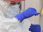 Laboratórium v Brne odhalilo dosiaľ nepopísanú mutáciu koronavírusu