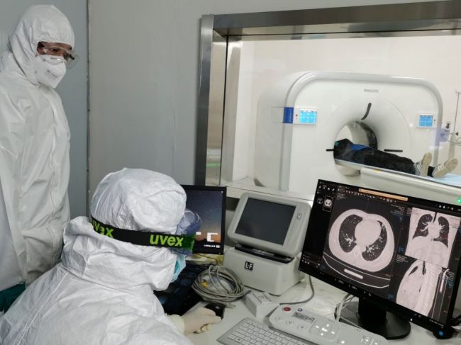WHO hovorí o ďalšom možnom zdroji koronavírusu