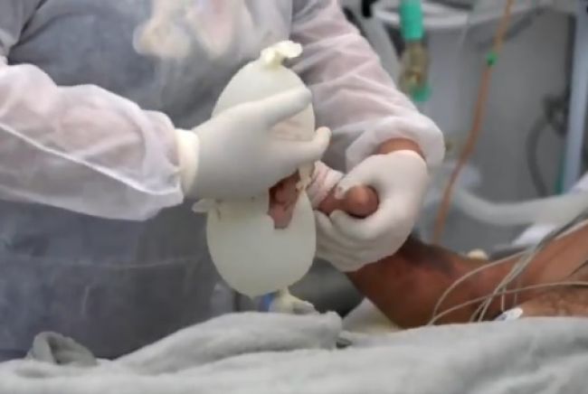 Video: Zdravotné sestry takto pomáhajú pacientom s COVID-19. Stačia rukavice a voda