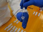 Z testovania museli stiahnuť šaržu antigénových testov