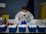 Na Slovensku odobrali zatiaľ 57 vzoriek odpadových vôd, sledujú nový koronavírus
