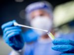 V nedeľu pribudlo 15 nakazených a 4 obete ochorenia COVID-19