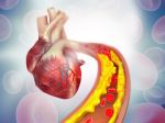 Zvýšený cholesterol sa týka čoraz viac mladých ľudí