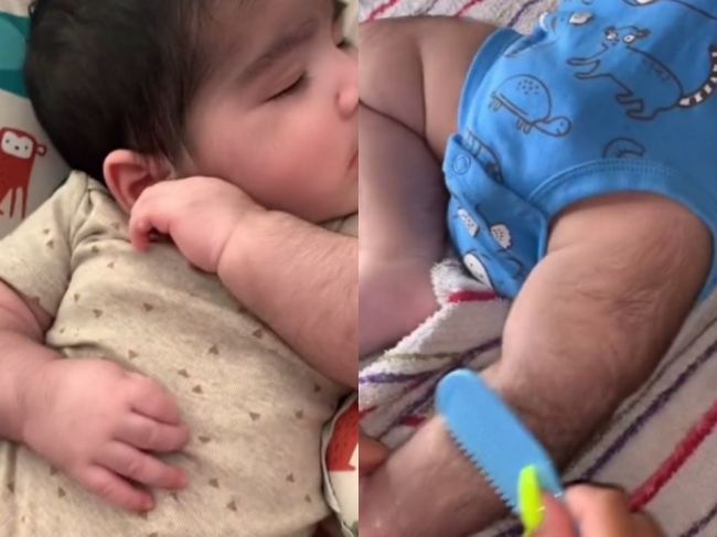 Video: Svojmu bábätku musím česať chlpy na tele. Za všetko môžu lieky