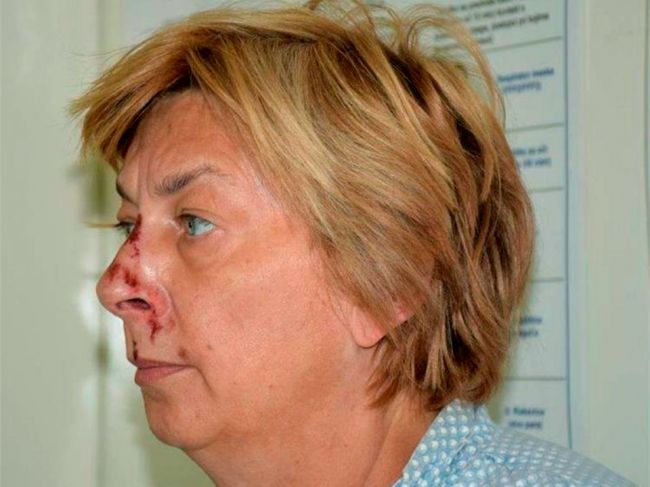 Žena so stratou pamäti, ktorú našli na ostrove Krk, je Slovenka