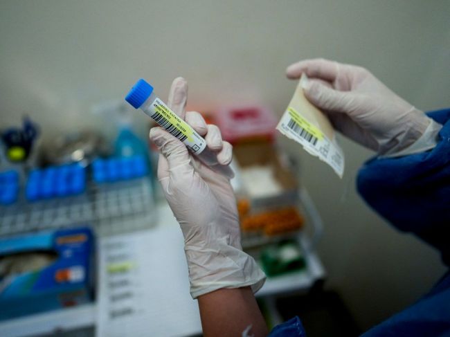 Pribudlo viac ako 5300 nakazených a ďalších 36 obetí