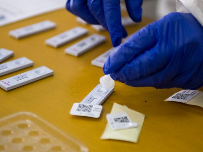 Na Slovensku pribudlo 61 obetí covidu, pozitivita testov sa pohybuje okolo 34 percent