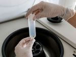 ÚVZ testoval vzorky odpadových vôd, v tomto kraji je najviac pozitívnych s koronavírusom