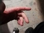 Opitý a agresívny muž sa pri spacifikovaní zahryzol policajtovi do ruky