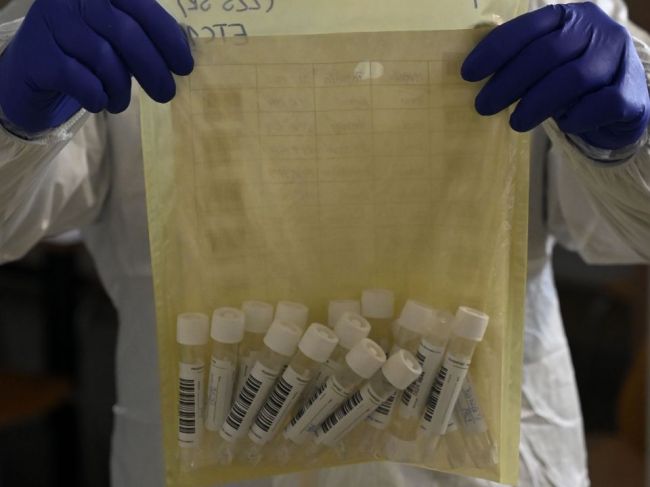 Pribudlo viac ako 4200 nakazených, najviac v Žilinskom kraji