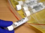 Na Slovensku pribudlo 216 prípadov nákazy novým koronavírusom