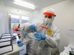 Najviac pozitívnych PCR testov bolo vo vekovej skupine od 35 do 44 rokov