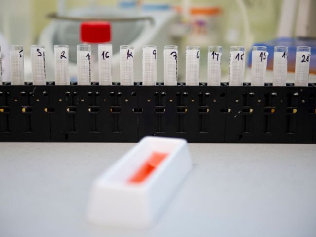 MZ SR analyzuje podávanie monoklonálnych protilátok vzhľadom na omikron