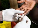 V Holandsku odhalili nový, nebezpečnejší variant HIV