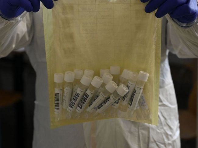 Asociácia súkromných laboratórií: Kapacity na PCR testy máme naplnené na 70 až 90 percent