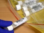 Na Slovensku pribudlo 8552 prípadov nákazy koronavírusom a 10 obetí