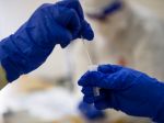 Na Slovensku pribudlo 2840 prípadov nákazy novým koronavírusom a 23 obetí