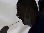 WHO je znepokojená klesajúcim počtom vykonaných testov na koronavírus