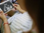 Počet potratov sa na Slovensku medziročne znížil o vyše desať percent