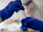 Na Slovensku pribudlo 553 prípadov nákazy koronavírusom a deväť obetí