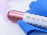 WHO vyšetruje súvislosť záhadnej hepatitídy s adenovírusom a covidom