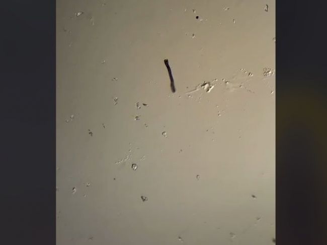 Video: Čistá voda z fastfoodu pod mikroskopom: Tento pohľad vydesí aj vás