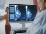 Obrovský prelom v liečbe rakoviny prsníka: Tento liek dokáže zmenšiť nádory