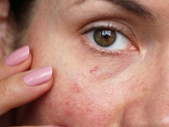Stukovatenie pečene: 8 príznakov v tvári, ktoré ho okamžite prezradia