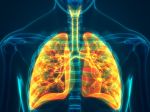 Nebezpečný emfyzém vám môže prederaviť pľúca. Ako ho rozoznať od menej závažných ochorení?