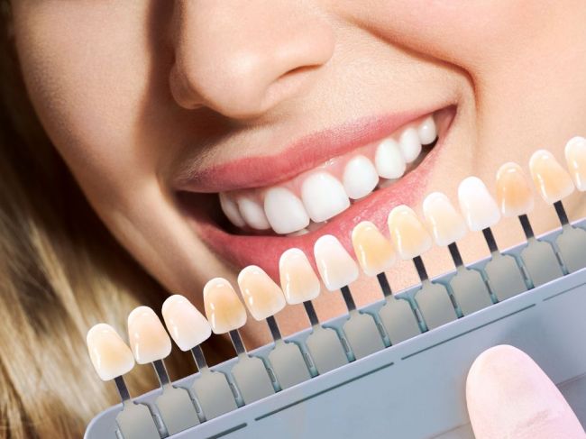 Co kolor zębów mówi o Twoim zdrowiu?