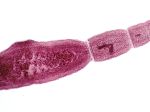 Parazitologička upozorňuje: Výskyt echinokokózy stúpa