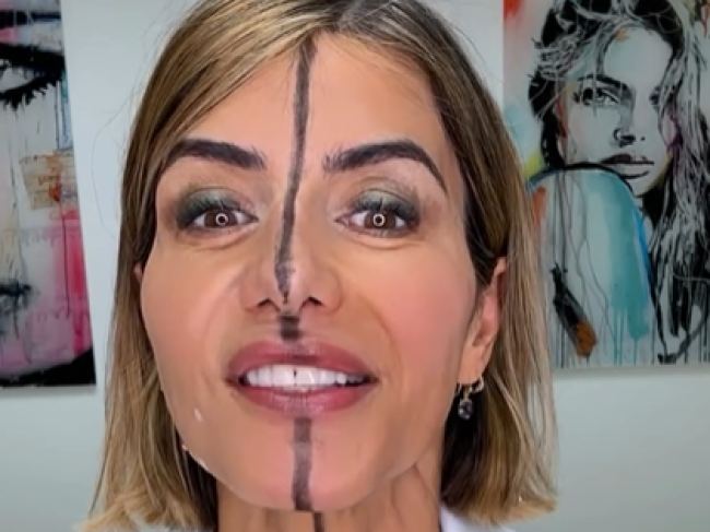 Lekárka si dala botox len na jednu stranu tváre. Dokážete spoznať, ktorú?