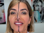 Lekárka si dala botox len na jednu stranu tváre. Dokážete spoznať, ktorú?