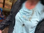 Turistov v Česku zasiahol blesk