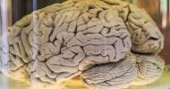 Výskumníci vytvorili najväčší archív zachovaných mozgov našich predkov: Niečo také nemalo byť možné